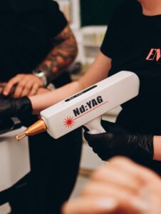 Détatouage laser professionnel sur peau tatouée