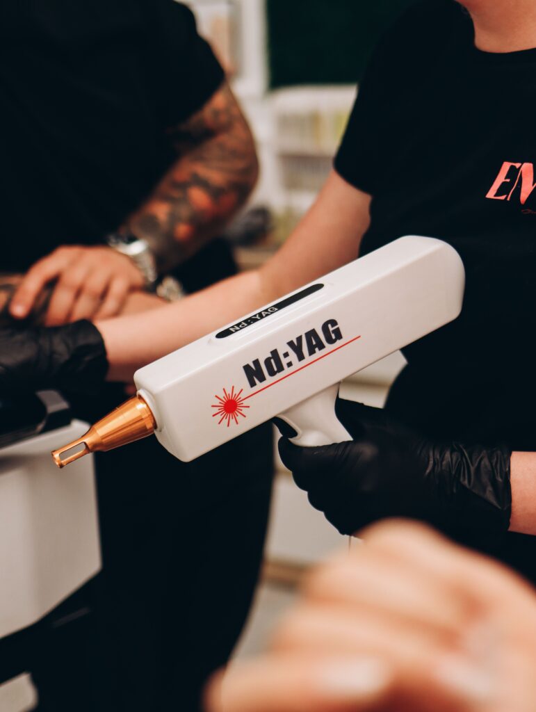 Détatouage laser professionnel sur peau tatouée