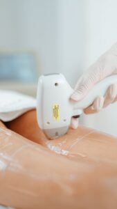 Épilation laser professionnelle sur les jambes en institut