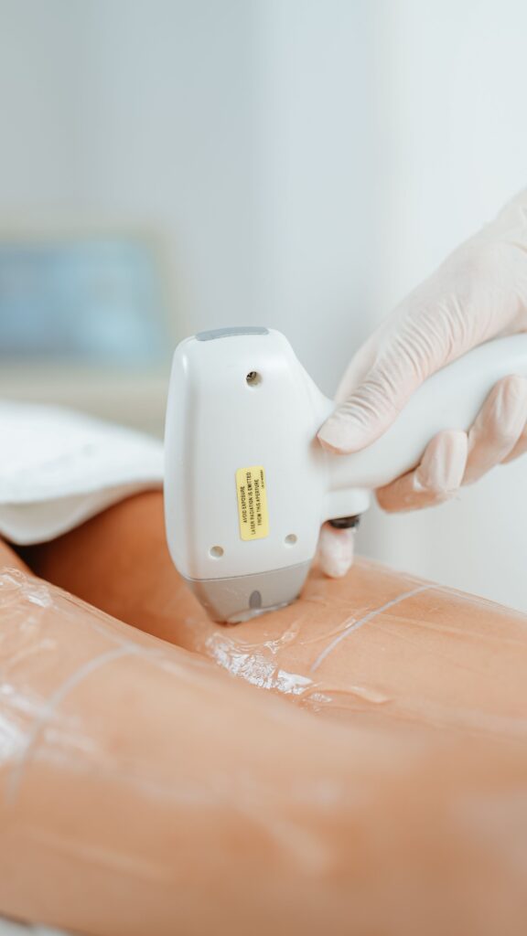 Épilation laser professionnelle sur les jambes en institut