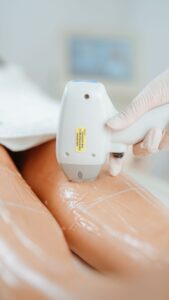 Traitement d'épilation définitive au laser en institut de beauté